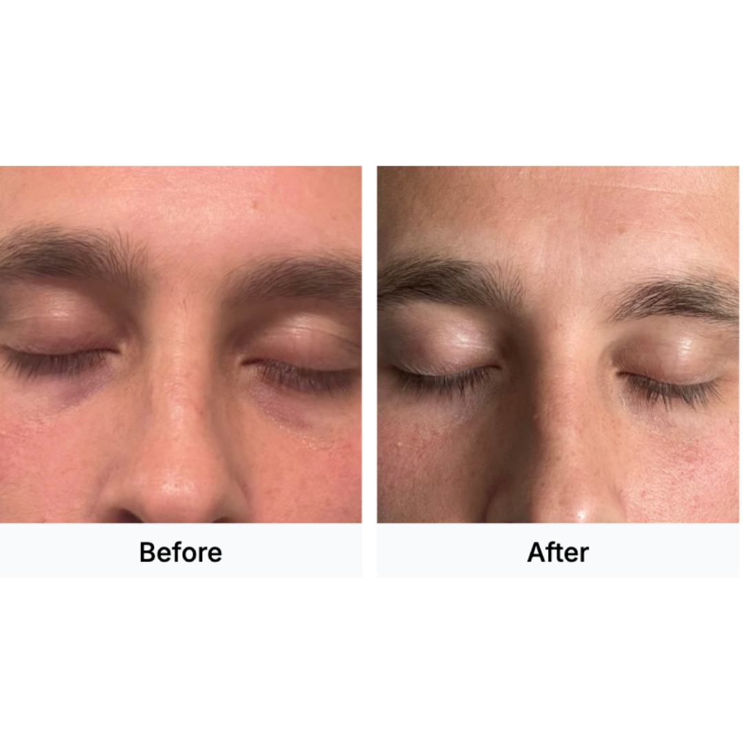 Eye Defense+ Performance Eye Serum