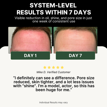Before and after comparison of skin texture with text highlighting system-level results within 7 days.
