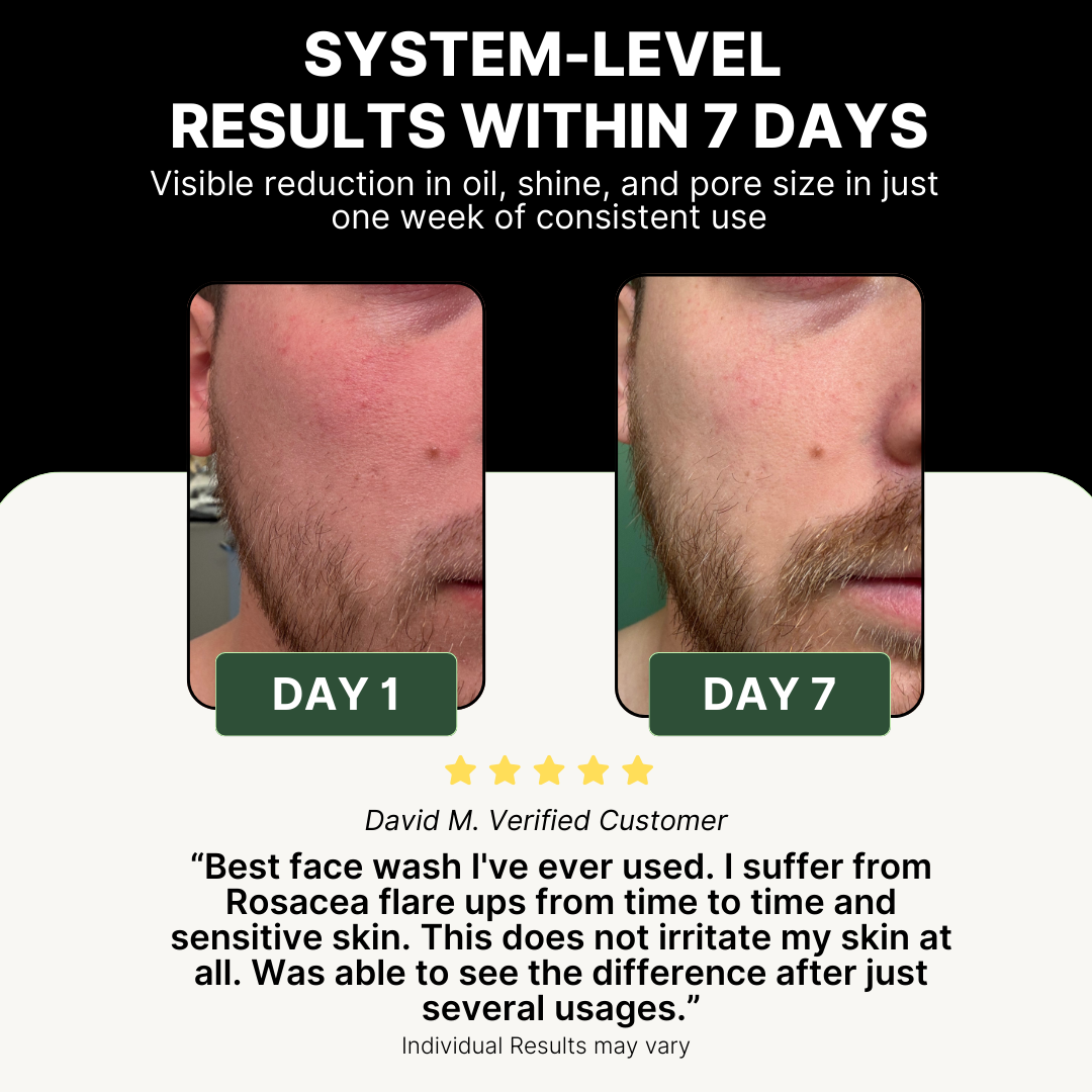 Before and after comparison of a person's face with text about system-level results within 7 days.