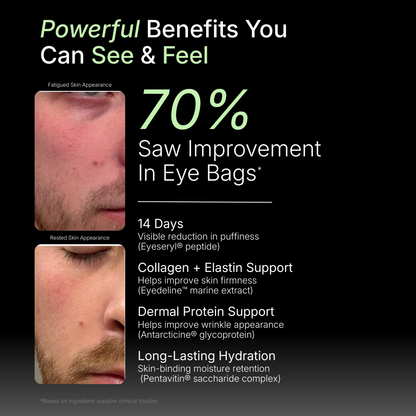 Before and After. Minimial eye bags after using Benjjimens Executive Skin System 