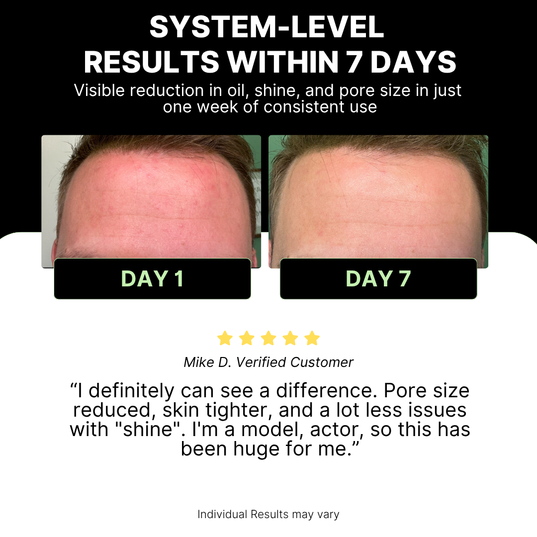 Before and after comparison of skin texture with text highlighting system-level results within 7 days.