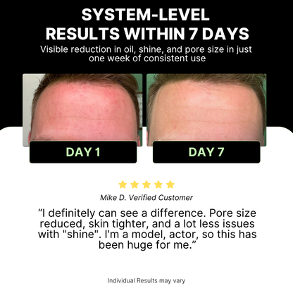 Before and after comparison of skin texture with text highlighting system-level results within 7 days.