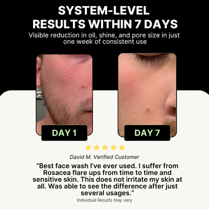 Before and after comparison of a person's face with text highlighting system-level results within 7 days.