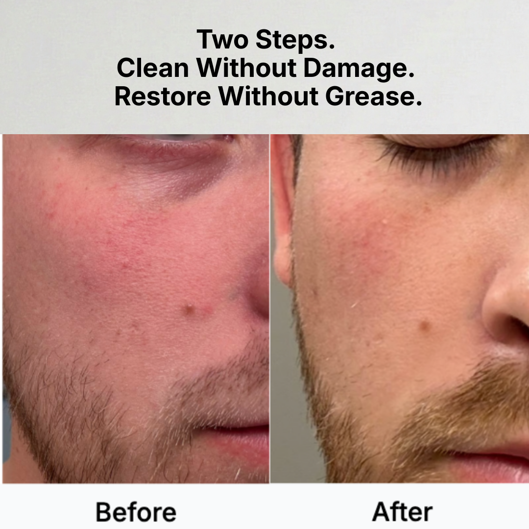 Before and after comparison of a person's face with acne, showing the product's effectiveness.