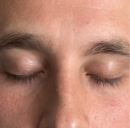 Clear Eye Bags 