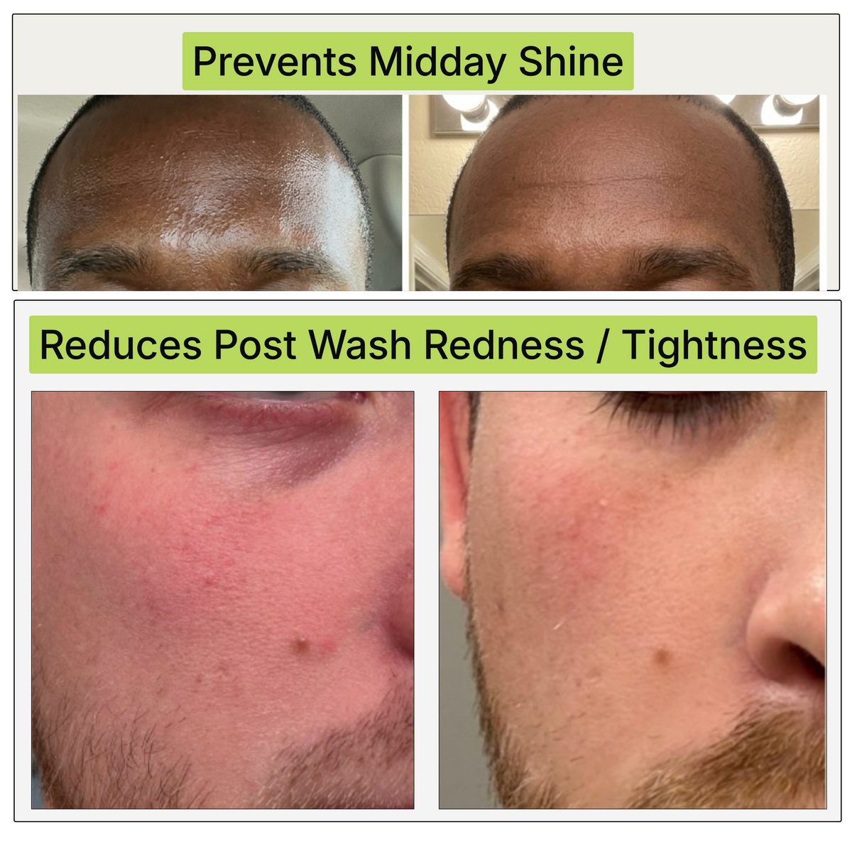 Before-and-after comparison collage showing skin results, with text banners reading 'Prevents Midday Shine' and 'Reduces Post Wash Redness / Tightness'.