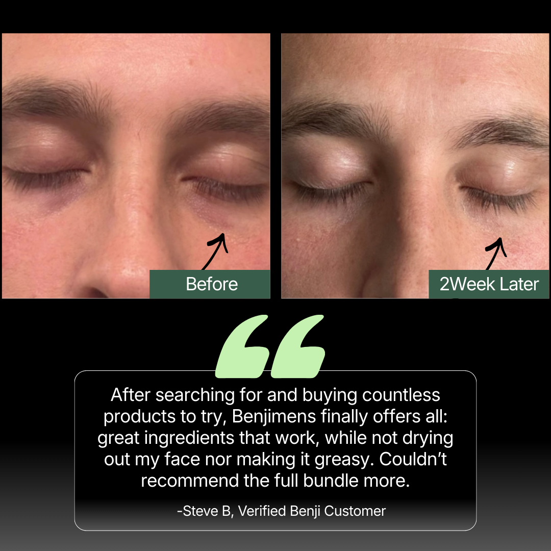 After searching for an buying countless products, benji offers it all: Great ingredients that work, while not drying out my face. All other products in the trash