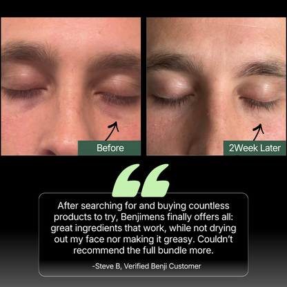 After searching for an buying countless products, benji offers it all: Great ingredients that work, while not drying out my face. All other products in the trash